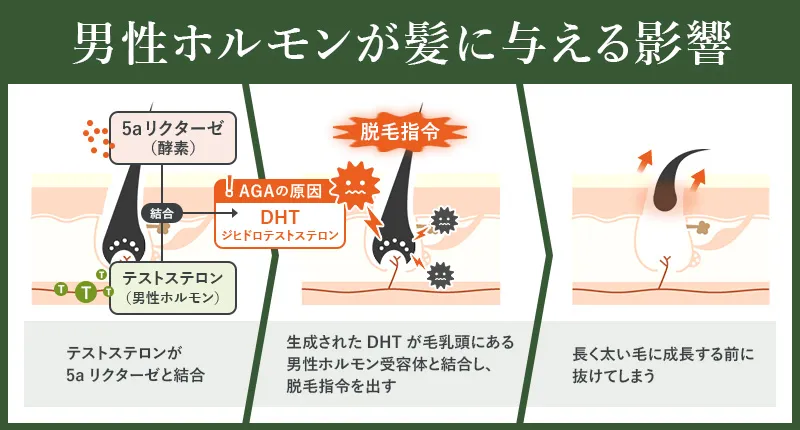 男性ホルモンのAGAへの影響