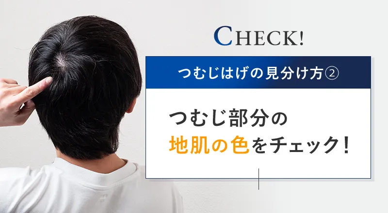 つむじの地肌の色によるAGAチェック