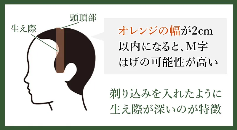 生え際が後退しているか確認する方法