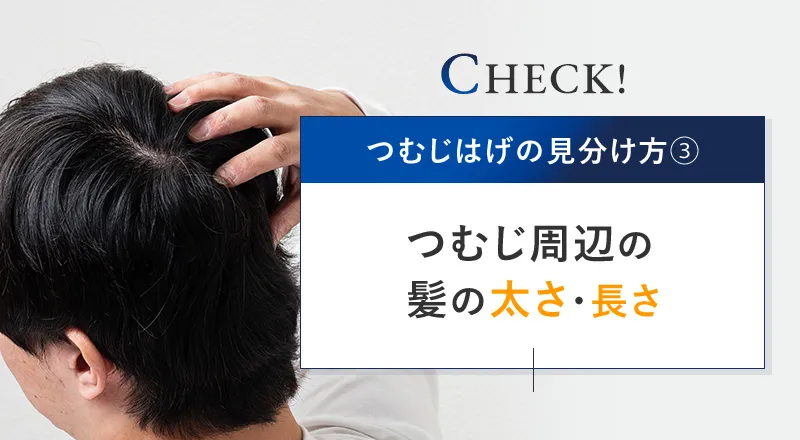 つむじはげを髪の太さ・長さで見分ける方法