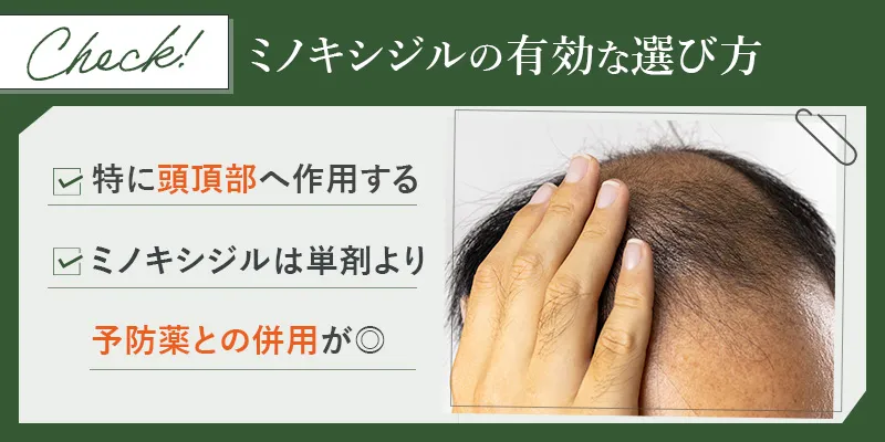 ミノキシジル(内服薬・外用薬)の通販での正しい購入方法と効果や副作用の基本 - 医療法人社団 医進会 銀座 小田クリニック