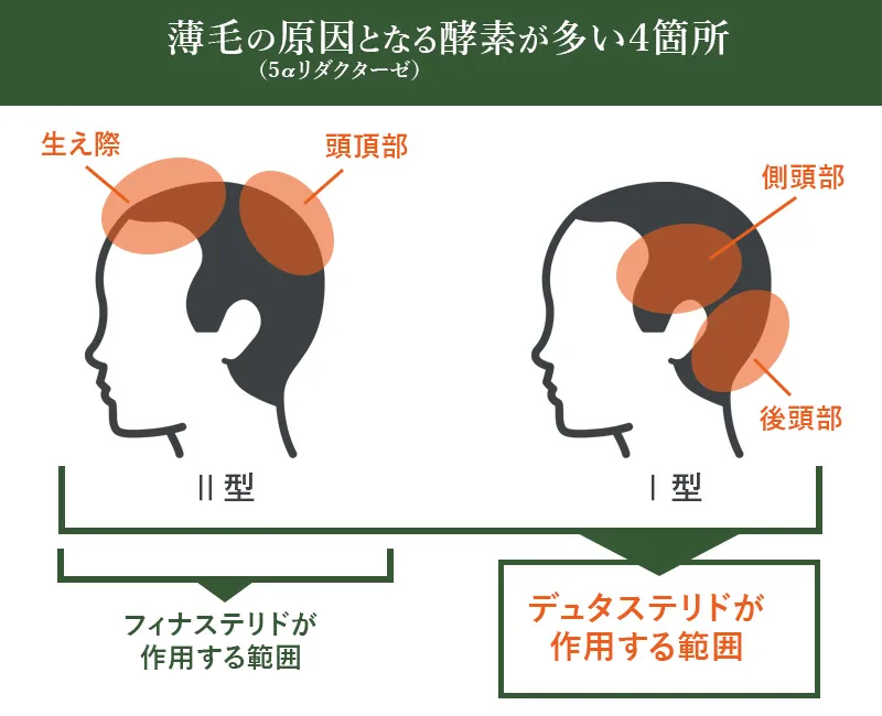 デュタステリドの作用範囲