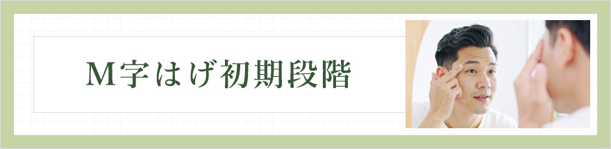 M字はげ初期段階