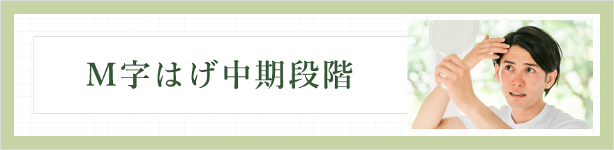 M字はげ中期段階