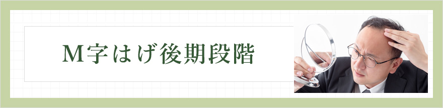 M字はげ後期段階