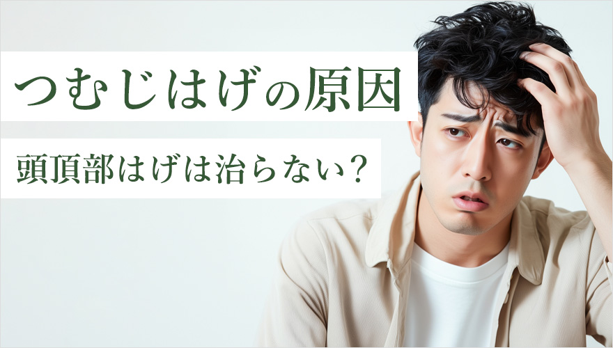 つむじはげの原因と頭頂部ハゲは治らないのか