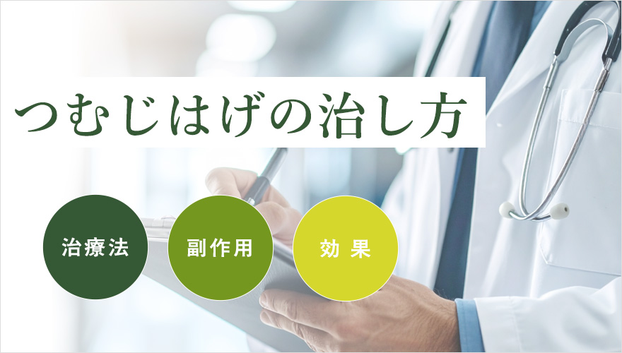つむじはげの治し方、治療薬を紹介