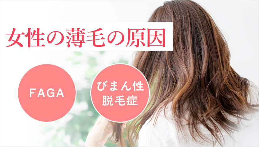 女性薄毛の原因:FAGA・びまん性脱毛症