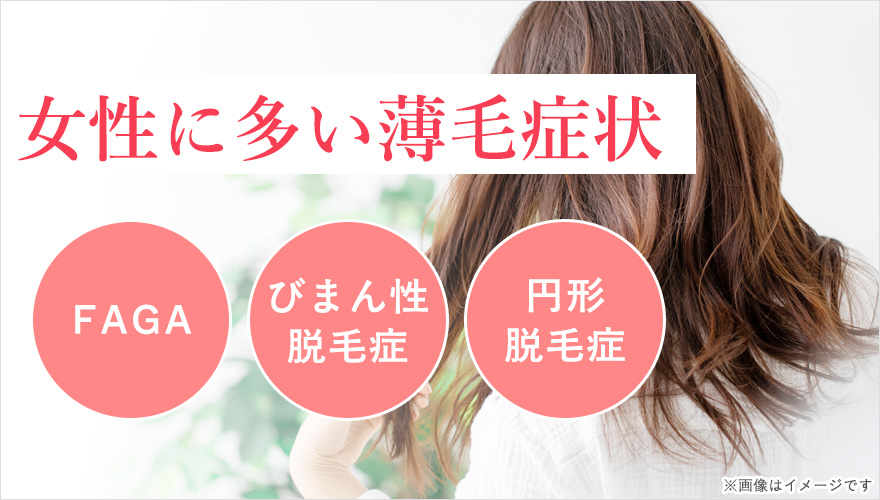 女性の薄毛：FAGA・びまん性脱毛症・円形脱毛症