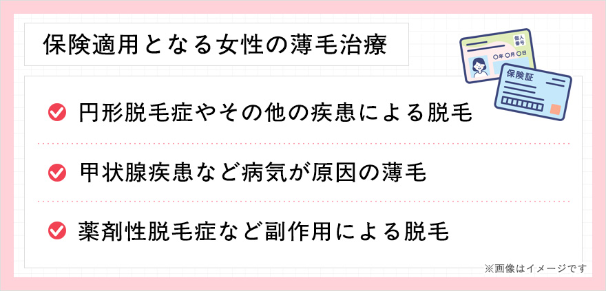 保険適用となる女性の薄毛治療一覧