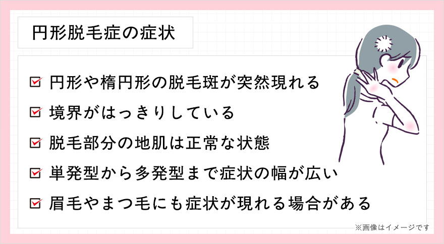 円形脱毛症の症状一覧